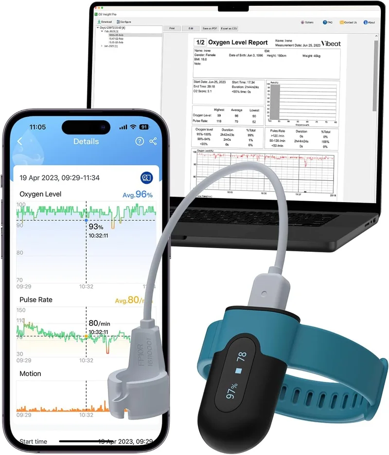 Vibeat OxyU Wrist Pulse Oximeter - Rank 4 in Best Oximeter of 2025